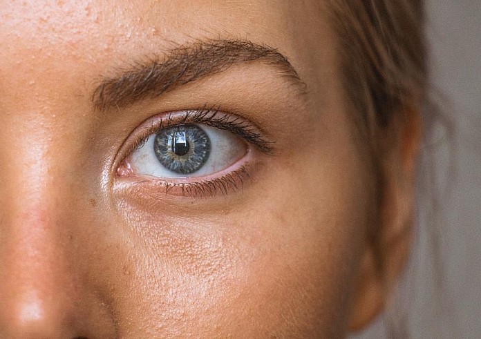 Οι 4 πιο κοινές αιτίες της εμφάνισης μαύρων κύκλων κάτω από τα μάτια
