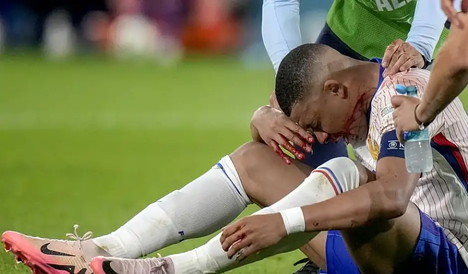Euro 2024: Κάταγμα στην μύτη ο Μπαπέ – Θα παίζει με προστατευτική μάσκα