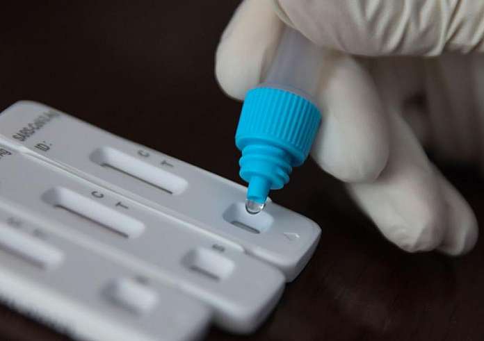 Πανεπιστήμιο John Hopkins: Όλα όσα πρέπει να γνωρίζετε για το JN.1, την πιο πρόσφατη παραλλαγή Omicron του κορονοϊού