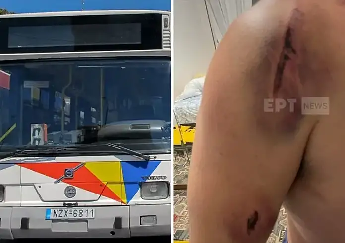 «Με χτυπούσαν στο κεφάλι και το σώμα» – Σοκάρει η εικόνα του οδηγού που έπεσε θύμα ξυλοδαρμού στη Θεσσαλονίκη