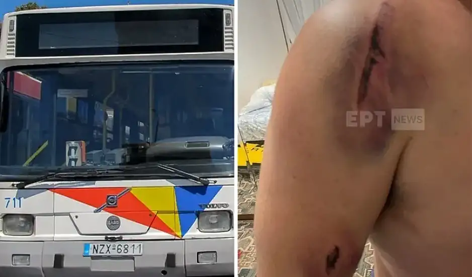 «Με χτυπούσαν στο κεφάλι και το σώμα» – Σοκάρει η εικόνα του οδηγού που έπεσε θύμα ξυλοδαρμού στη Θεσσαλονίκη