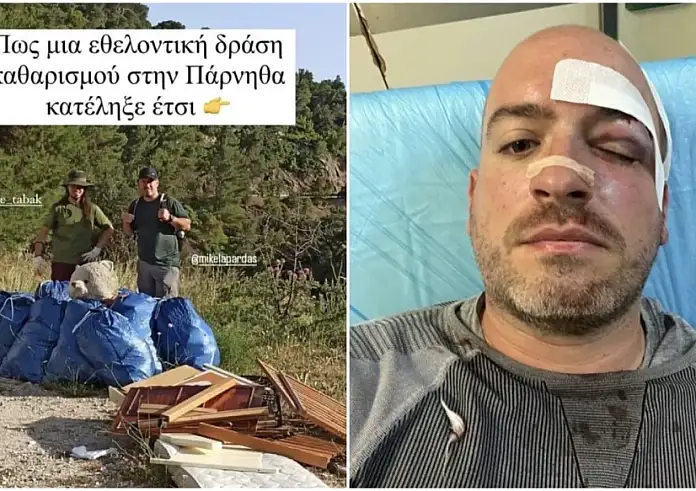 Πάρνηθα: Άγρια επίθεση σε εθελοντές που καθάριζαν την περιοχή