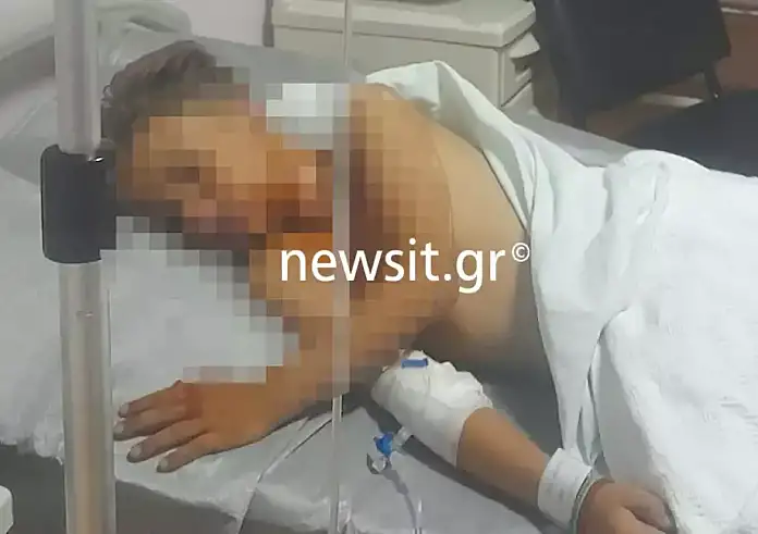Πάτρα: «Ζήσαμε εμπόλεμες συνθήκες, ο γιος μου με ρώτησε αν θα πεθάνει», λέει στο newsit.gr ο πατέρας του 9χρονου που τραυματίστηκε από βεγγαλικά