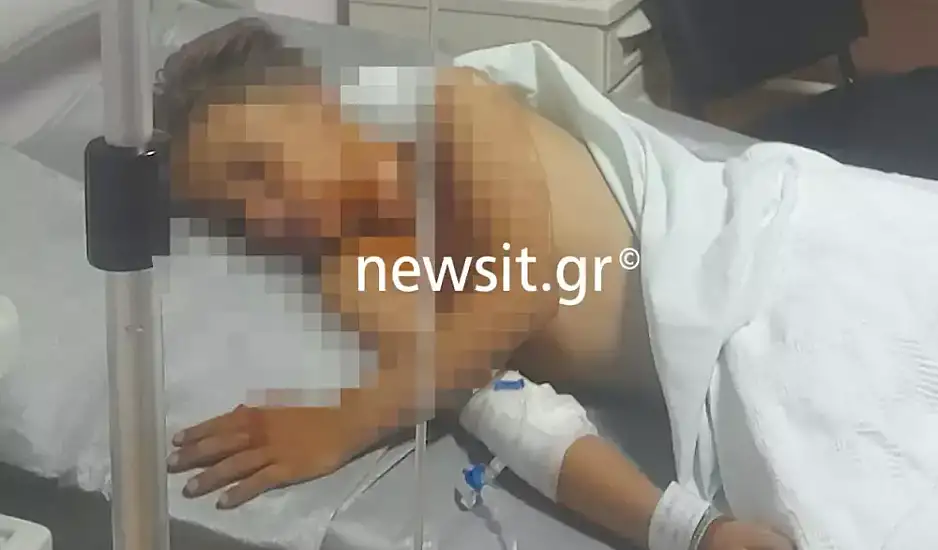 Πάτρα: «Ζήσαμε εμπόλεμες συνθήκες, ο γιος μου με ρώτησε αν θα πεθάνει», λέει στο newsit.gr ο πατέρας του 9χρονου που τραυματίστηκε από βεγγαλικά
