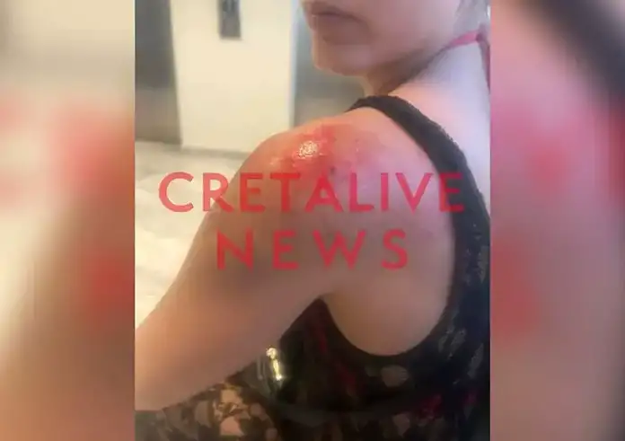 Ηράκλειο: Φωτογράφισε κρυφά 25χρονη, την χτύπησε με μηχανάκι και την έσυρε για 20 μέτρα