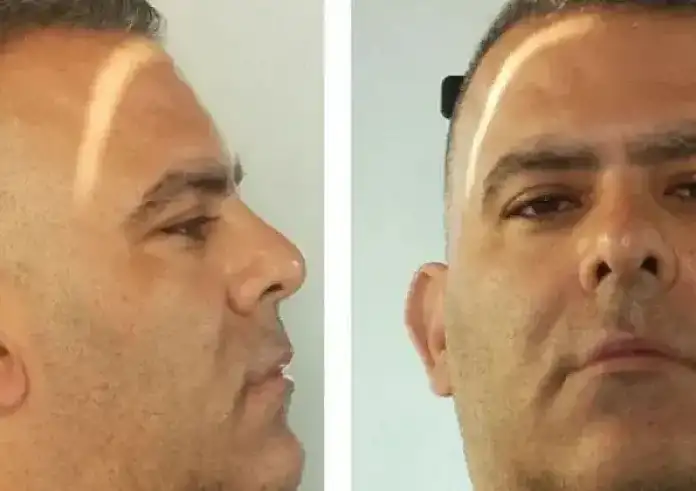 Πρέπει να έχεις ανοιχτό μυαλό: Ανήλικοι στην Σάμο μιλούν για τον γυμνασιάρχη