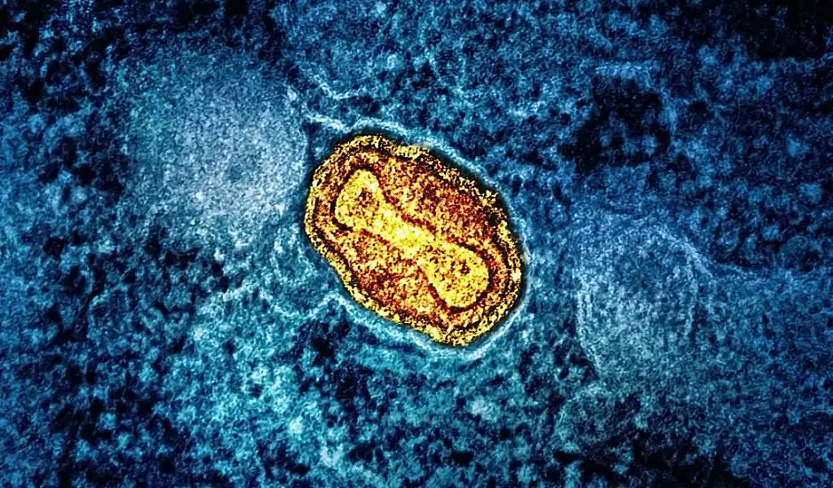 Συναγερμός για την εξάπλωση του ιού Mpox στην Ευρώπη – Πώς μεταδίδεται και ποιοι κινδυνεύουν