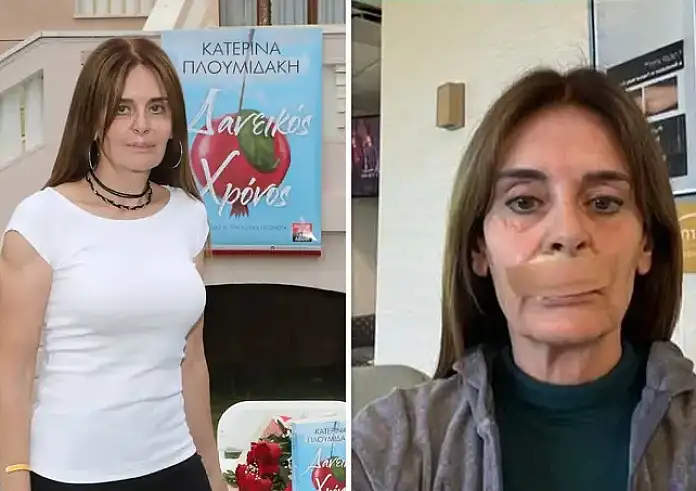 Κατερίνα Πλουμιδάκη: Έχω κάνει 21 χειρουργεία. Μάχη αποκατάστασης μετά από ιατρικό λάθος