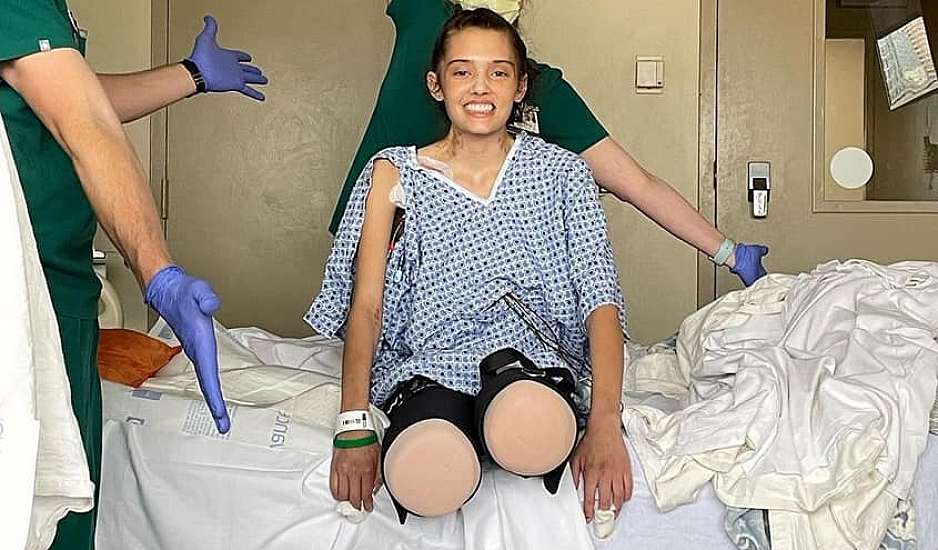 Κορονοϊός: 21χρονο μοντέλο έχασε και τα δυο της πόδια μετά από επιπλοκές