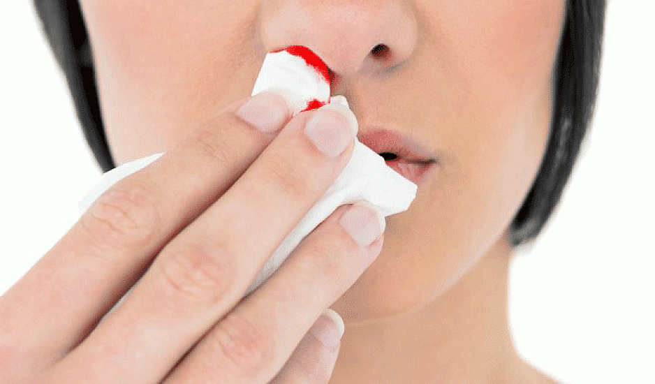 Αίμα από την μύτη: Πώς το σταματάμε και ποια είναι τα λάθη που κάνουμε συχνά