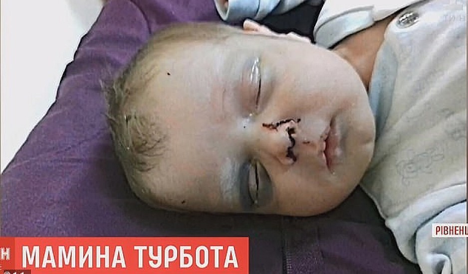 Φρίκη στην Ουκρανία: Μητέρα έσπασε στο ξύλο το ενός μηνός μωρό της - Δίνει μάχη για τη ζωή του