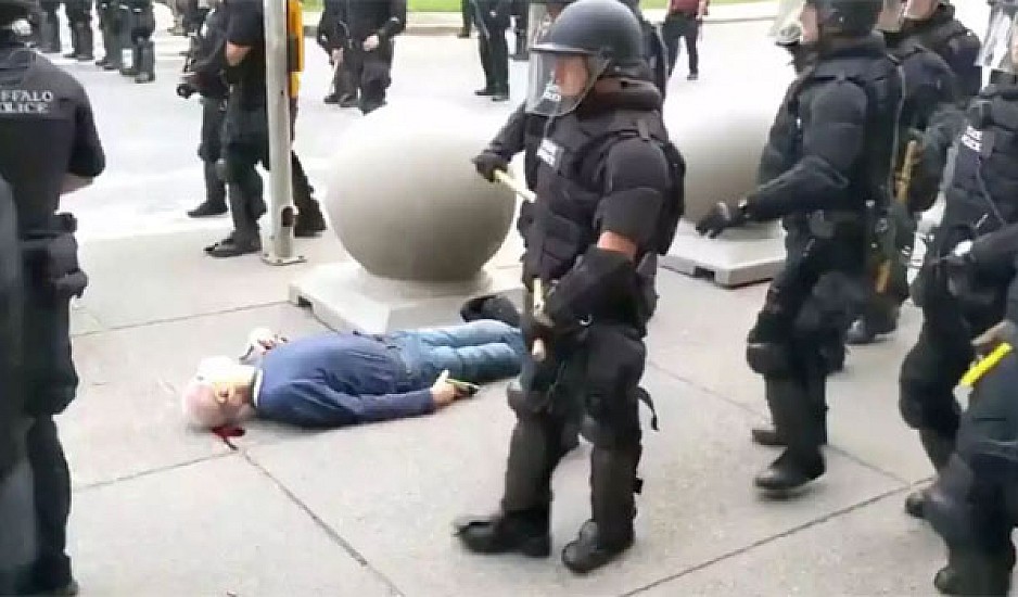 Αστυνομικοί σπρώχνουν 75χρονο στη Νέα Υόρκη και τον τραυματίζουν σοβαρά