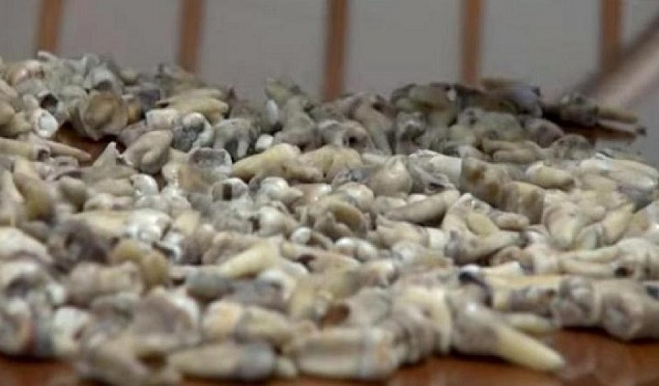 Μυστήριο με 1000 ανθρώπινα δόντια που βρέθηκαν μέσα σε τοίχο διαμερίσματος