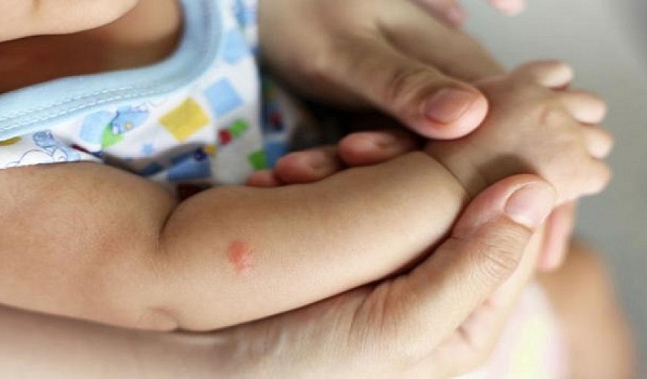 Κουνούπια: Αυτό είναι το κόλπο για να μην σας τσιμπούν