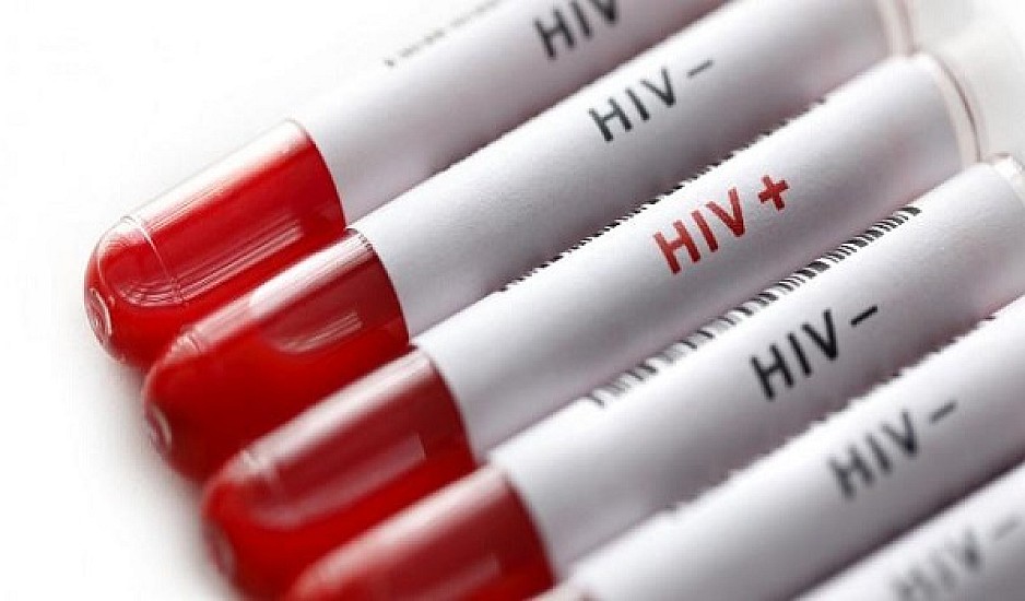 Ιός του AIDS: Μείωση στα κρούσματα, αύξηση στους ετεροφυλόφιλους