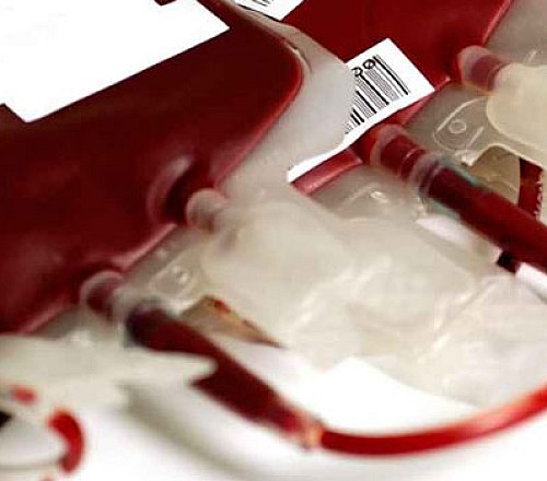Σκάνδαλο μολυσμένου αίματος: Παιδιά χρησιμοποιήθηκαν ως «πειραματόζωα» σε κλινικές δοκιμές