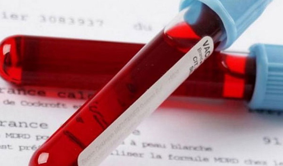 Ανακάλυψαν το πρώτο τεστ αίματος που ανιχνεύει με ακρίβεια 50 τύπους καρκίνου