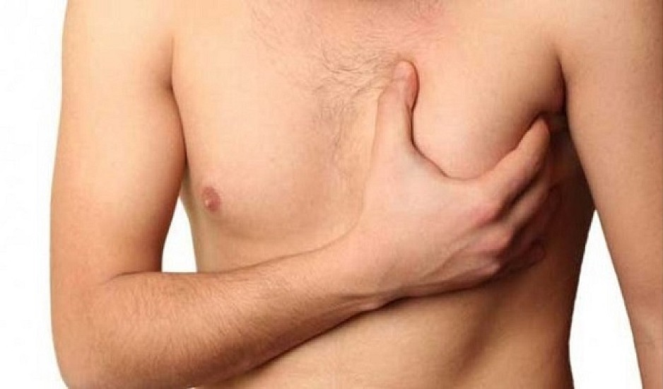 Καρκίνος του μαστού στους άνδρες: Τα 5 σημάδια που σώζουν ζωές