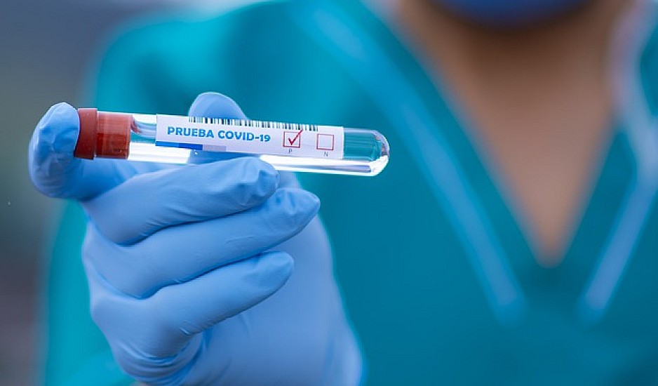 Ποιες κατηγορίες εργαζομένων θα κάνουν Self test; Πότε ξεκινά ο εμβολιασμός για τους υγιείς 40άρηδες