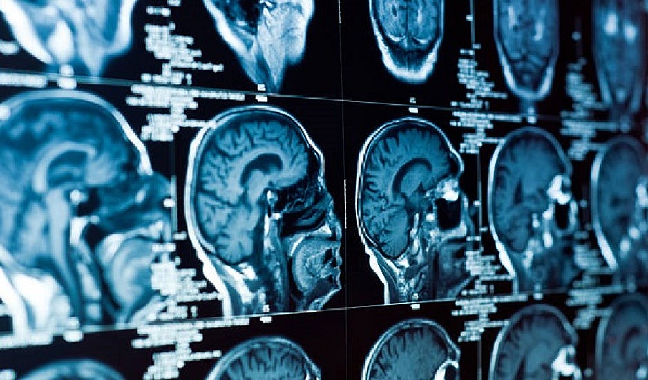 Ζωή μετά το θάνατο: Επιστήμονες "ανέστησαν" νεκρό εγκέφαλο τέσσερις ώρες μετά!