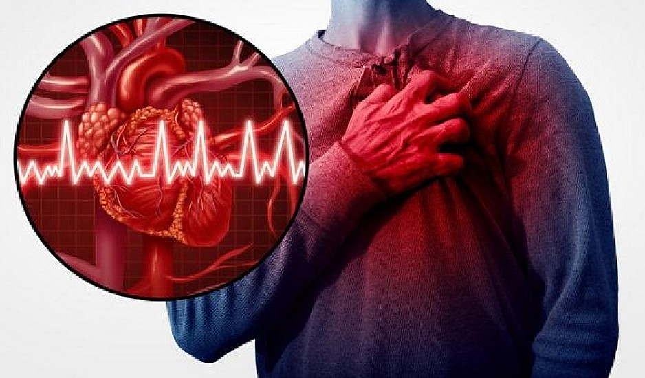 Καρδιακή προσβολή: Το πρώιμο σημάδι ενός εμφράγματος που λίγοι ξέρουν