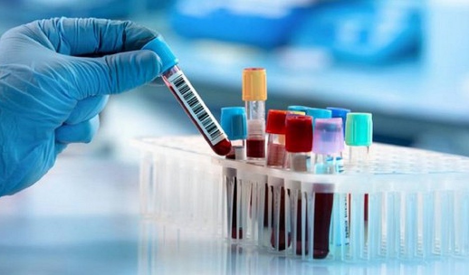 Υπό ανάπτυξη το πρώτο τεστ αίματος που προβλέπει ποιος είναι πιθανό να πάθει μακρά Covid-19
