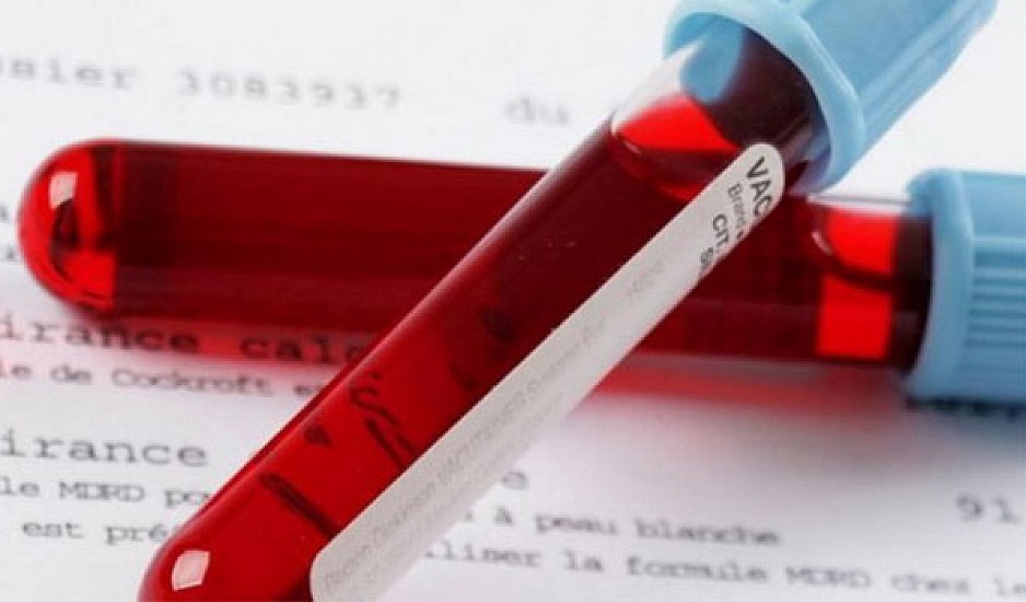 Εξέταση αίματος εντοπίζει τον καρκίνο των ωοθηκών έως και δύο χρόνια νωρίτερα