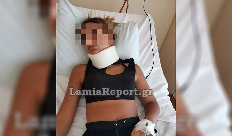 Ξυλοδαρμός 13χρονης στη Λαμία: Έχει τραύματα σε όλο το σώμα. Τα υποτιμητικά σχόλια στο Facebook