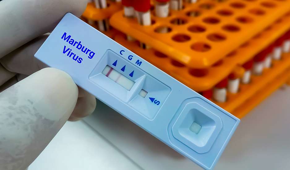ΠΟΥ: Παγκόσμια ανησυχία για τον θανατηφόρο ιό Μάρμπουργκ - Τι είναι και πώς μεταδίδεται