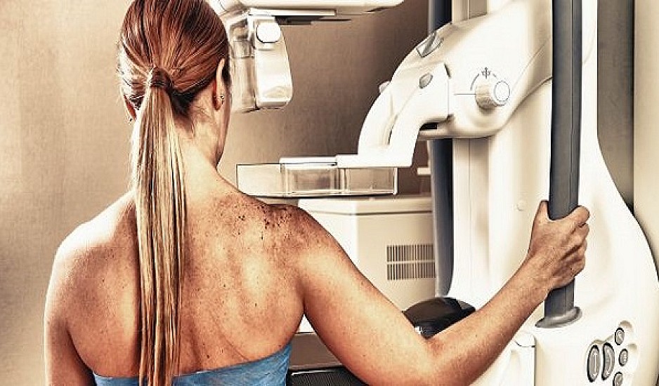 Μαστογραφία: Πόσο επικίνδυνη είναι η ακτινοβολία της εξέτασης