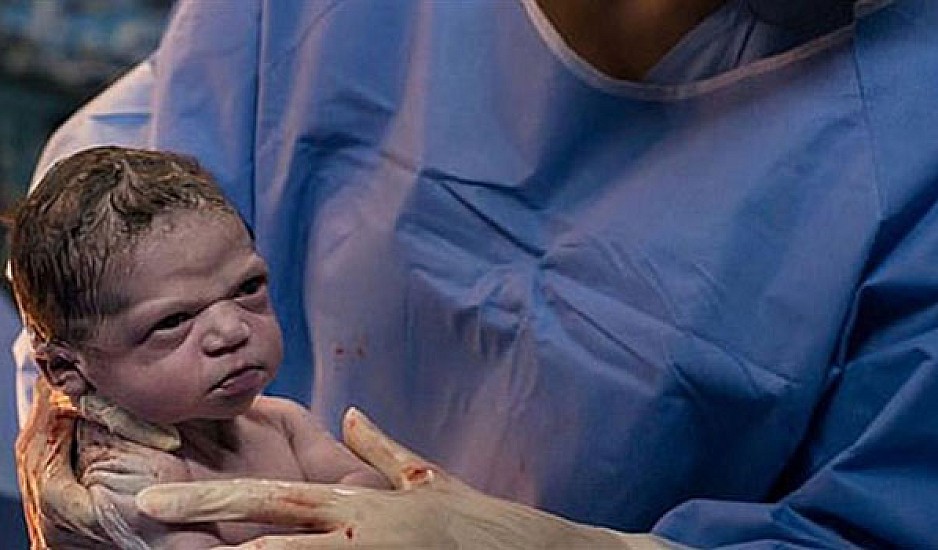 Το βλέμμα του μωρού που έγινε viral: Δείτε πως κοιτάζει τον γιατρό που το έφερε στον κόσμο