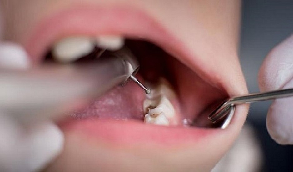 Ασθενείς έχασαν τα δόντια τους λόγω κορονοϊού