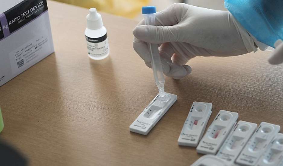 Σωματεία Ιδιωτικής Πρωτοβάθμιας Υγείας: Πώς διατίθενται PCR σε τιμές κάτω του κόστους;