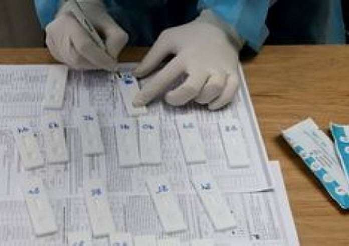ΕΟΔΥ: Πού θα διεξαχθούν δωρεάν rapid test τη Δευτέρα 3 Ιουλίου