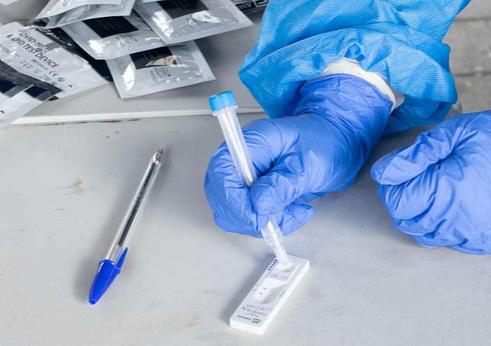 ΕΟΔΥ: Σε ποια σημεία γίνοvται δωρεάν rapid test την Παρασκευή 21 Ιουλίου