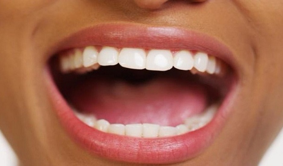 Θες λευκά δόντια; Αυτές οι τροφές θα σε βοηθήσουν