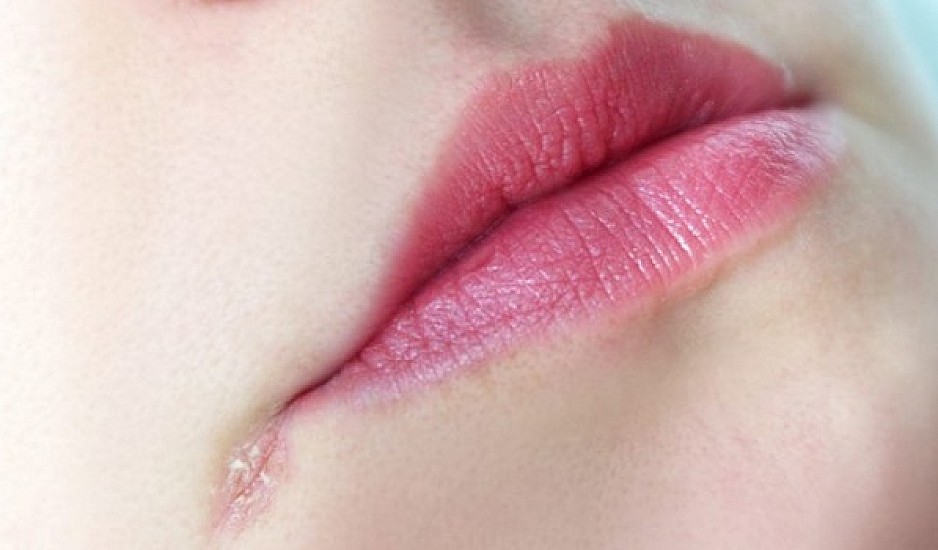 Οι Roomies σας φτιάχνουν μάσκες ενυδάτωσης για τα χείλη