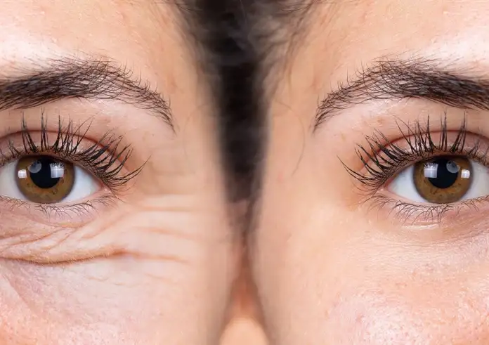Το concealer που πρέπει να επιλέξετε μετά τα 50 για να μειώσετε τις ρυτίδες