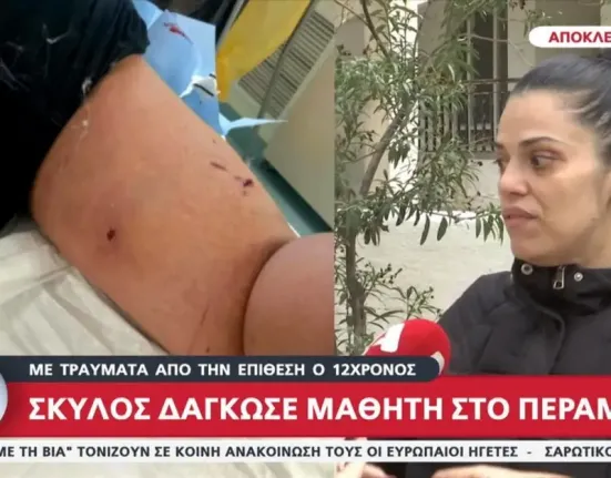 Σοβαρός τραυματισμός 12χρονου στο Πέραμα από επίθεση σκύλου – Στο Παίδων με πολλαπλές δαγκωματιές