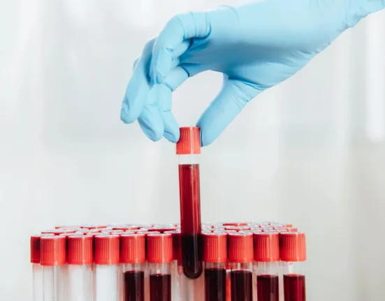 Νόσος του Crohn: Η απλή εξέταση αίματος που «προδίδει» την πάθηση χρόνια πριν τα συμπτώματα