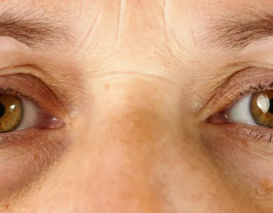 Το σημάδι στο πρόσωπο που «προδίδει» την άνοια: Τι αποκαλύπτει το «πόδι της χήνας» για την υγεία του εγκεφάλου