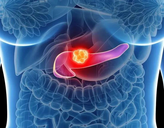 Καρκίνος παγκρέατος: Το «αθόρυβο» σημάδι που εμφανίζεται 3 χρόνια πριν τη διάγνωση
