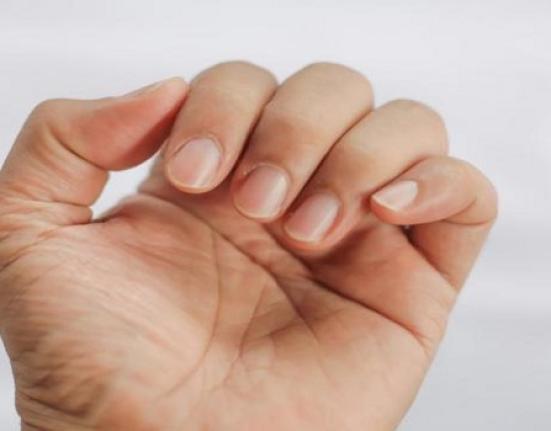 Δες πώς τα νύχια μαρτυρούν την κατάσταση του οργανισμού μας