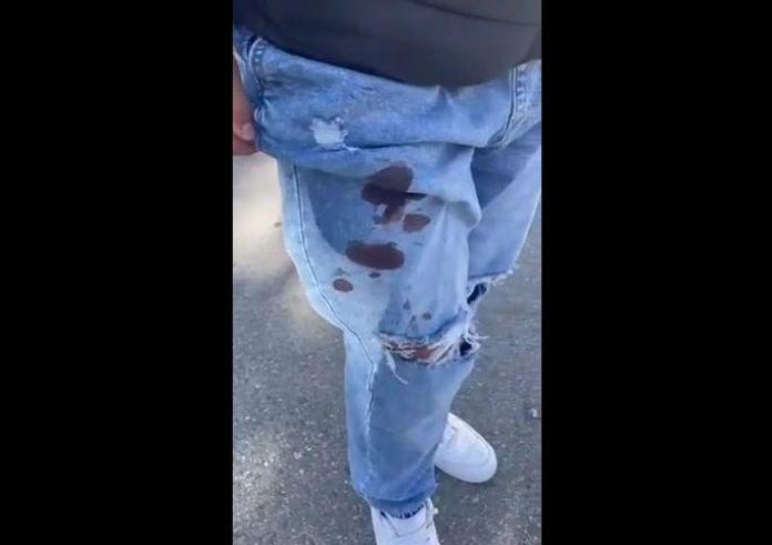 Μεσσήνη: 14χρονος μαχαίρωσε συμμαθητή του με σουγιά