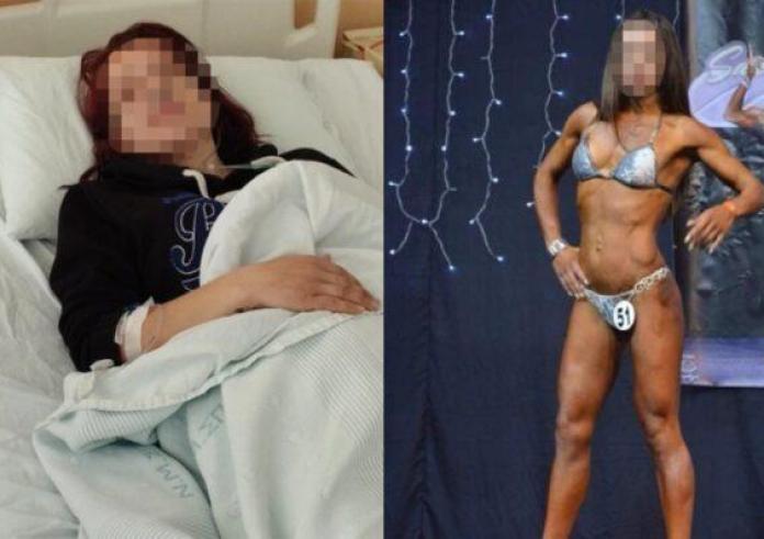 Σπάρτη: Πρώην bodybuilder έπεσε θύμα ξυλοδαρμού από τον σύζυγό της – Με χτυπούσε στο πάτωμα με μανία