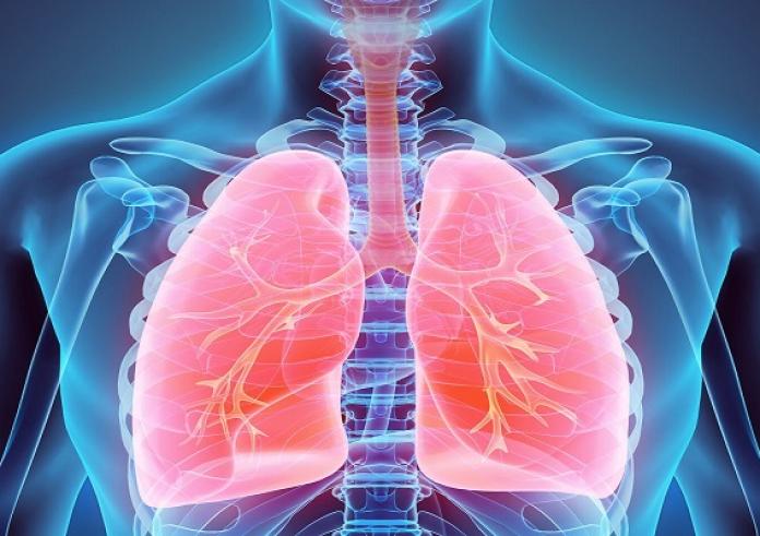 Θετικά αποτελέσματα από θεραπεία για τον καρκίνο του πνεύμονα σε πρώιμο στάδιο