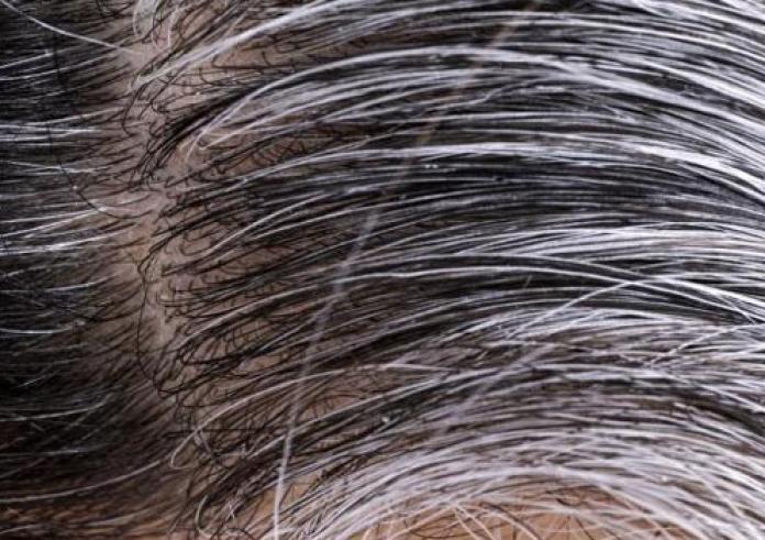 Πώς μπορούμε να αναζωογονήσουμε τα μαλλιά που γκριζάρουν και αραιώνουν