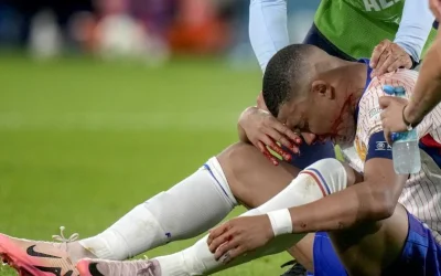 Euro 2024: Κάταγμα στην μύτη ο Μπαπέ – Θα παίζει με προστατευτική μάσκα