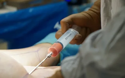 Επεμβάσεις ομορφιάς χωρίς γιατρούς: Θάνατοι και σοκαριστικές αποκαλύψεις για τα παράνομα fillers