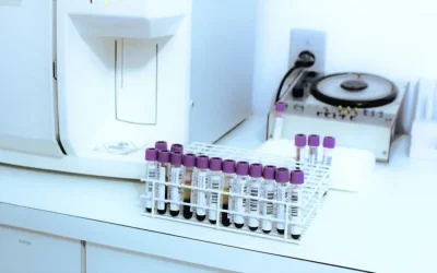 Λαμία: Εντοπίστηκε σαλμονέλα σε περισσότερες παρτίδες κοτόπουλου